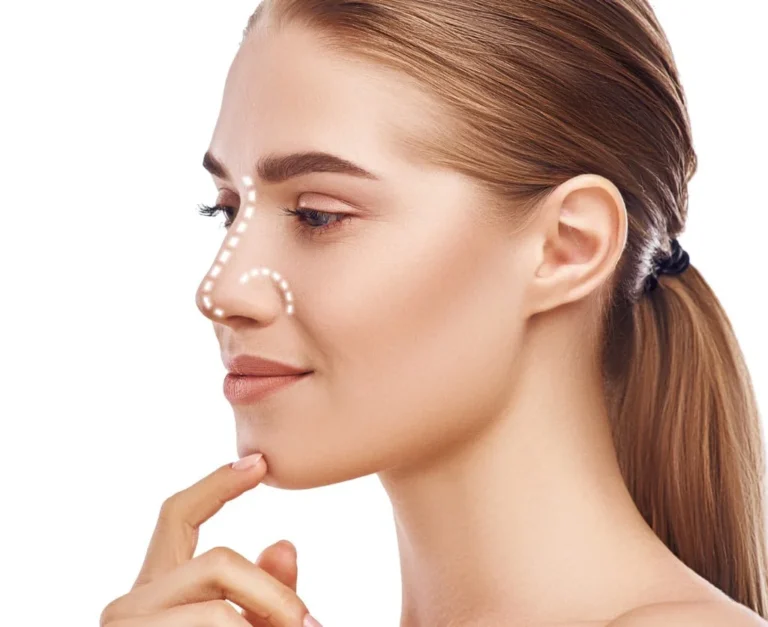 rhinoplasty-nose-surgery-side-view-of-attractive-young-woman-with-picture-id1142167563-1
